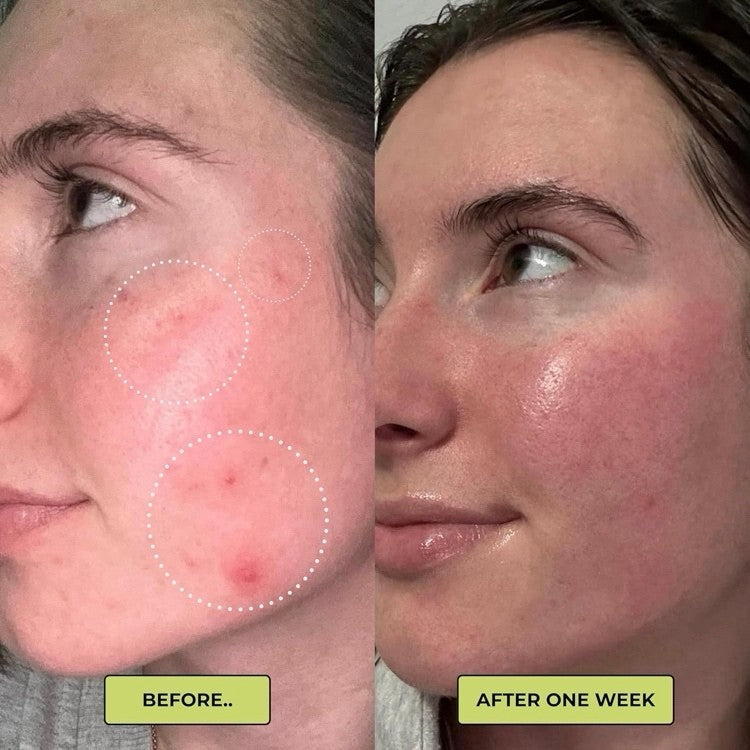 NOURISH DAILY MOISTURIZER